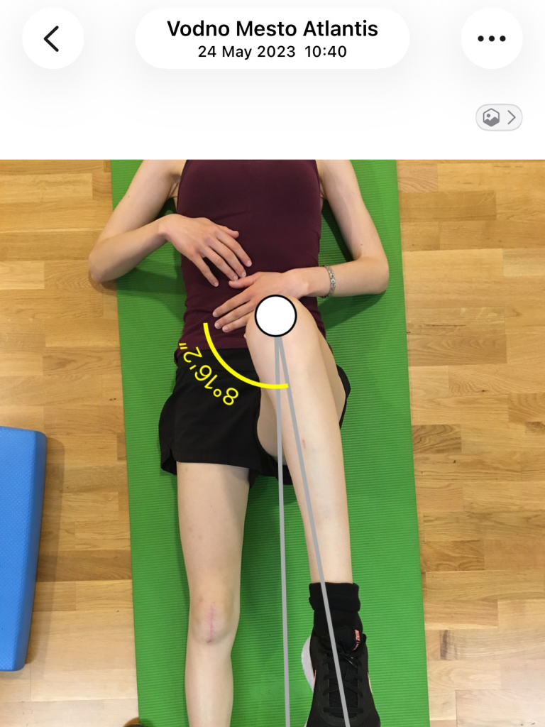 diagnostika telesa merjenje notranje rotacije v kolku 1. primer