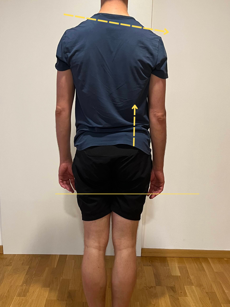 desna rama nižja od leve prikazuje nesorazmerje